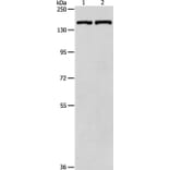 PTCH1 Antibody from Signalway Antibody (35897) - Antibodies.com