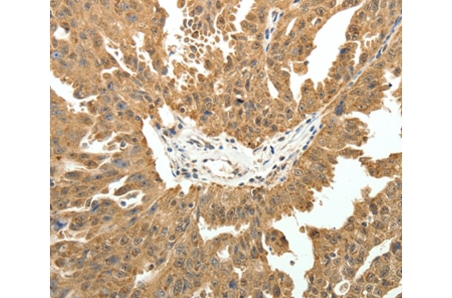 Immunohistochemistry - PTCH1 Antibody from Signalway Antibody (35897) - Antibodies.com