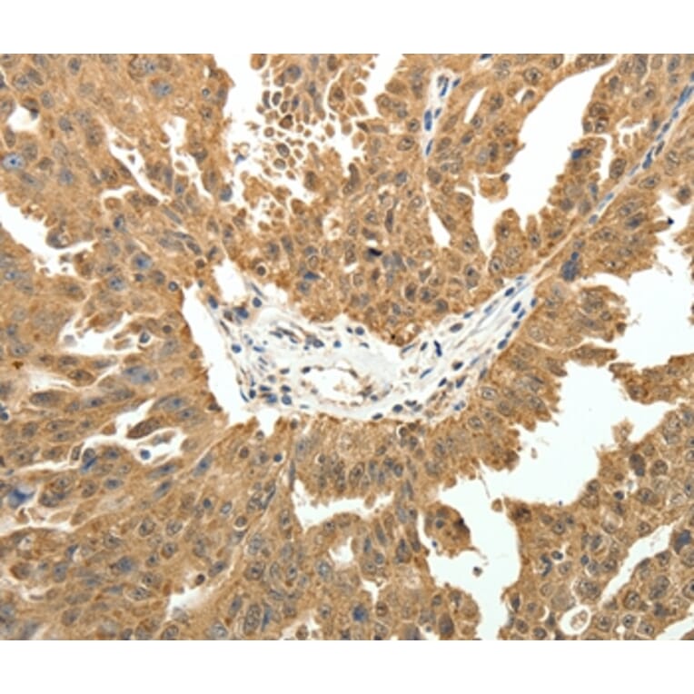 Immunohistochemistry - PTCH1 Antibody from Signalway Antibody (35897) - Antibodies.com