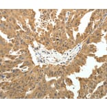 Immunohistochemistry - PTCH1 Antibody from Signalway Antibody (35897) - Antibodies.com