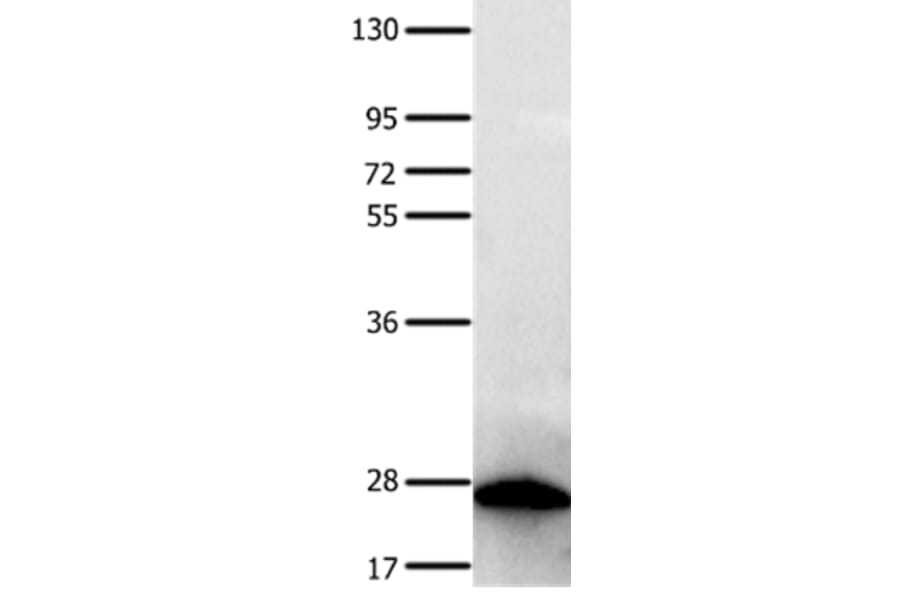 PTPRK Antibody from Signalway Antibody (35901) - Antibodies.com