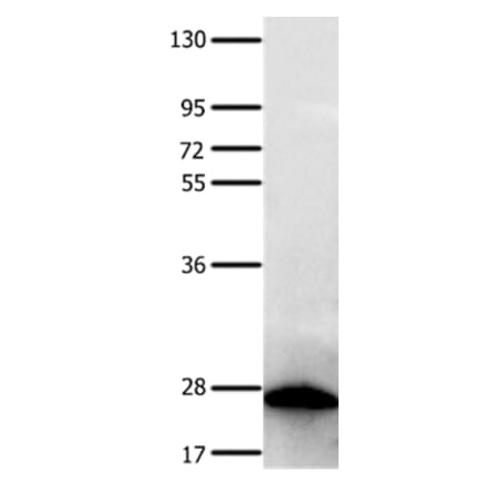 PTPRK Antibody from Signalway Antibody (35901) - Antibodies.com