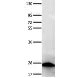 PTPRK Antibody from Signalway Antibody (35901) - Antibodies.com