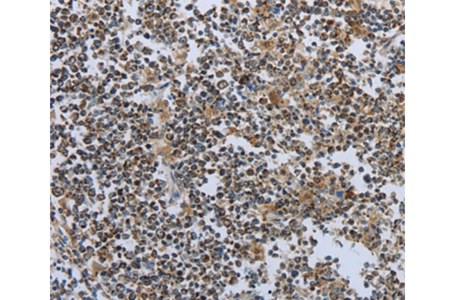Immunohistochemistry - PTPRK Antibody from Signalway Antibody (35901) - Antibodies.com