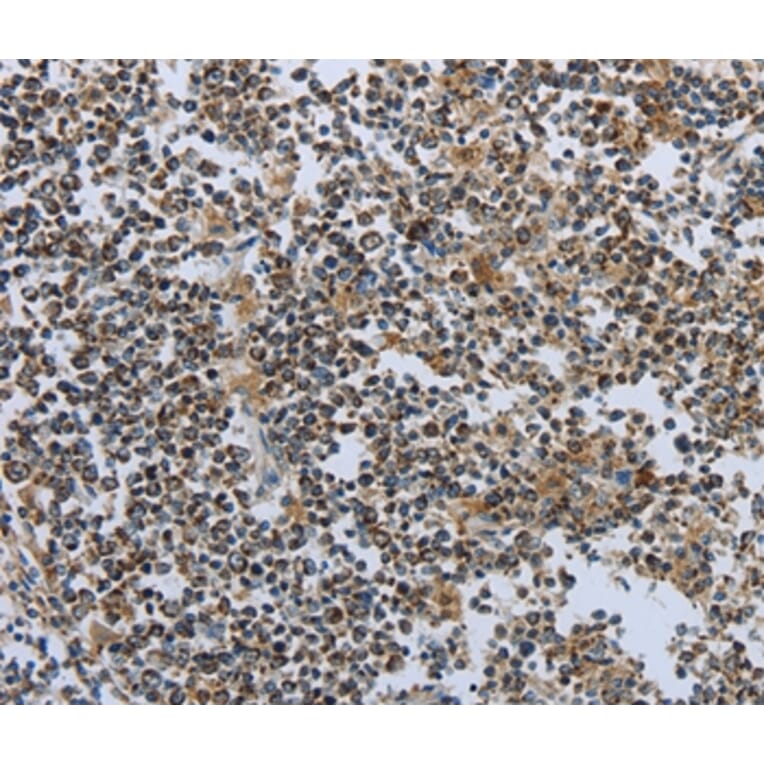 Immunohistochemistry - PTPRK Antibody from Signalway Antibody (35901) - Antibodies.com