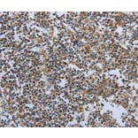 Immunohistochemistry - PTPRK Antibody from Signalway Antibody (35901) - Antibodies.com