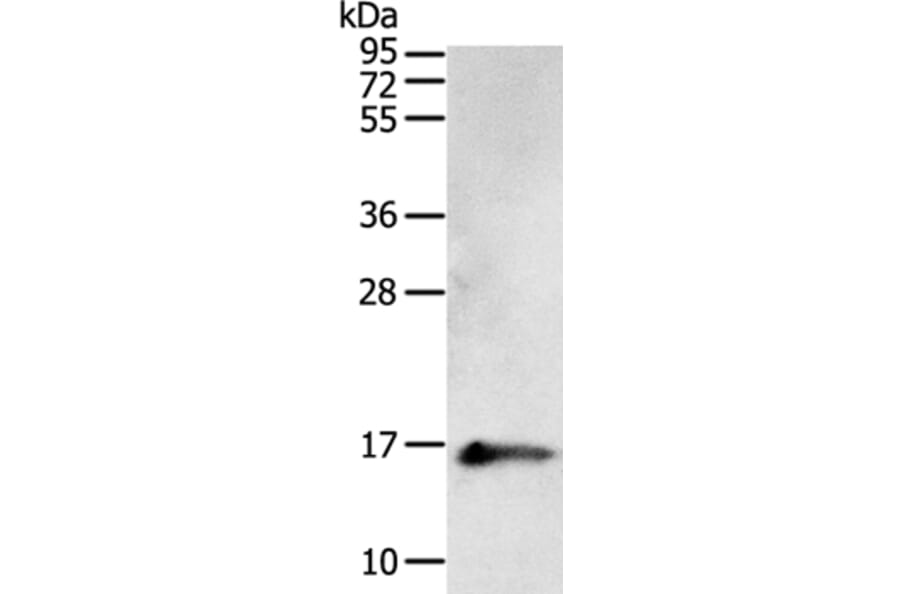 PVALB Antibody from Signalway Antibody (35902) - Antibodies.com