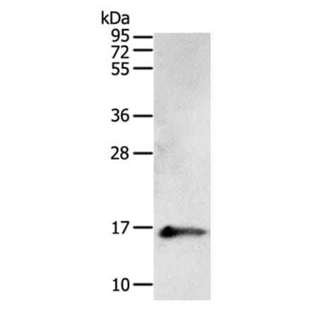 PVALB Antibody from Signalway Antibody (35902) - Antibodies.com