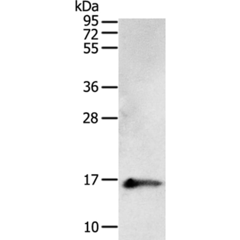 PVALB Antibody from Signalway Antibody (35902) - Antibodies.com