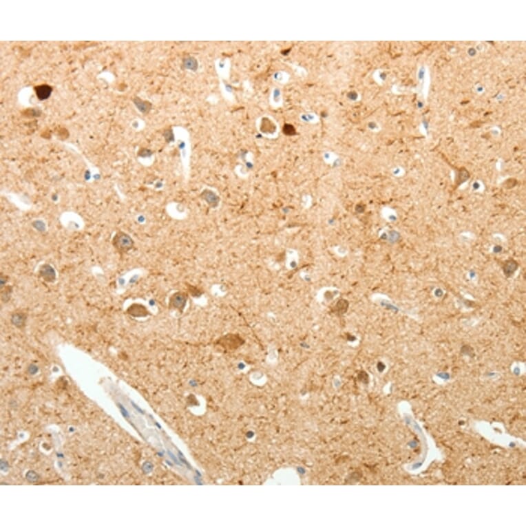 Immunohistochemistry - PVALB Antibody from Signalway Antibody (35902) - Antibodies.com