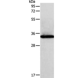 SIRT4 Antibody from Signalway Antibody (35914) - Antibodies.com