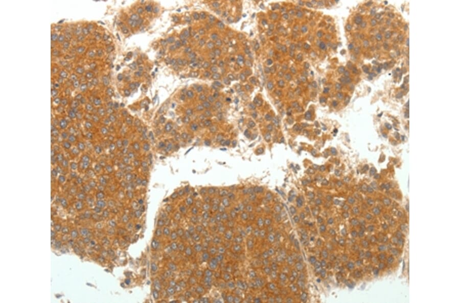 Immunohistochemistry - SIRT4 Antibody from Signalway Antibody (35914) - Antibodies.com