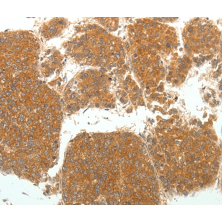 Immunohistochemistry - SIRT4 Antibody from Signalway Antibody (35914) - Antibodies.com