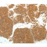 Immunohistochemistry - SIRT4 Antibody from Signalway Antibody (35914) - Antibodies.com