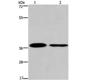 SNAI1 Antibody from Signalway Antibody (35921) - Antibodies.com