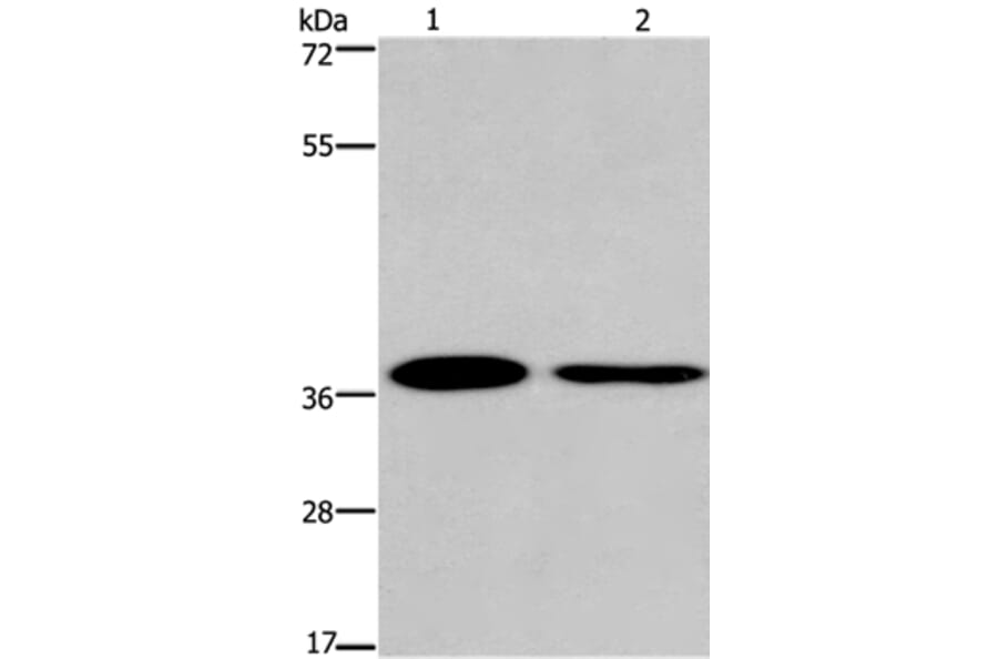 SNAI1 Antibody from Signalway Antibody (35921) - Antibodies.com