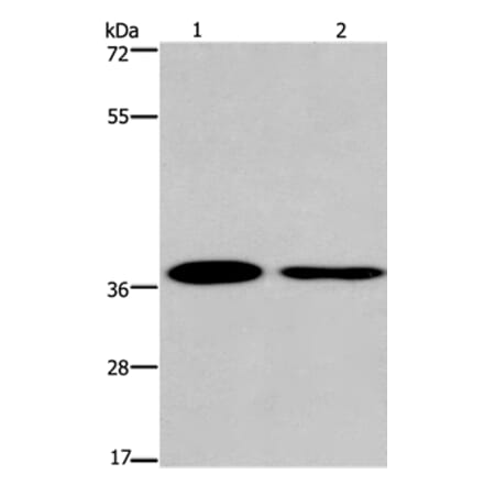 SNAI1 Antibody from Signalway Antibody (35921) - Antibodies.com