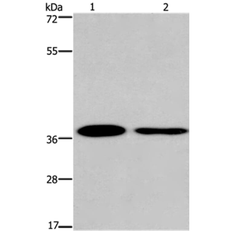 SNAI1 Antibody from Signalway Antibody (35921) - Antibodies.com