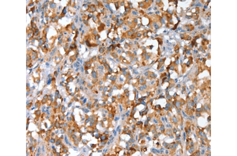 Immunohistochemistry - SNAI1 Antibody from Signalway Antibody (35921) - Antibodies.com