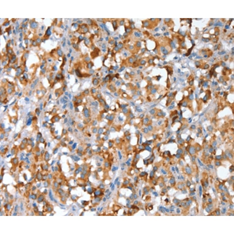 Immunohistochemistry - SNAI1 Antibody from Signalway Antibody (35921) - Antibodies.com
