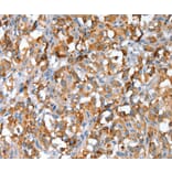Immunohistochemistry - SNAI1 Antibody from Signalway Antibody (35921) - Antibodies.com