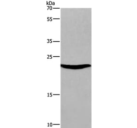 SOCS3 Antibody from Signalway Antibody (35924) - Antibodies.com