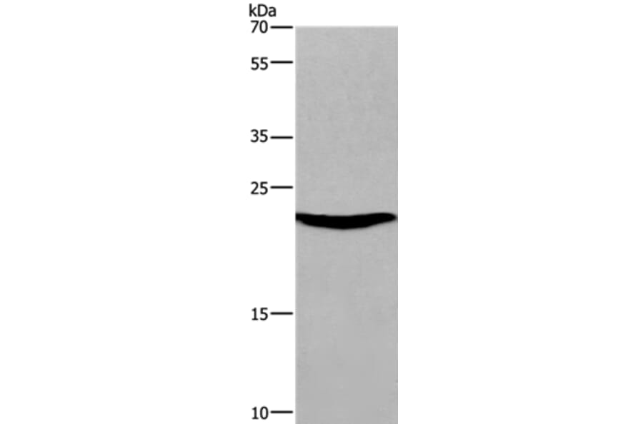 SOCS3 Antibody from Signalway Antibody (35924) - Antibodies.com