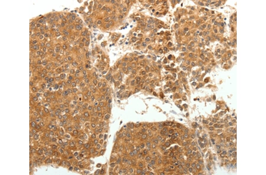 Immunohistochemistry - SOCS3 Antibody from Signalway Antibody (35924) - Antibodies.com