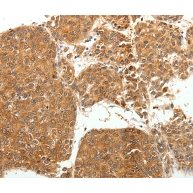 Immunohistochemistry - SOCS3 Antibody from Signalway Antibody (35924) - Antibodies.com