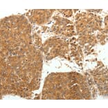Immunohistochemistry - SOCS3 Antibody from Signalway Antibody (35924) - Antibodies.com