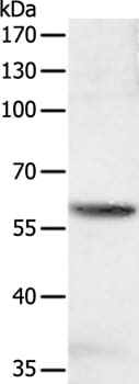 Gel: 10% SDS-PAGE Lysate: 40ug jurkat cell Primary antibody: 1/600 dilution Secondary antibody dilution: 1/8000 Exposure time: 1 second