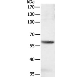SOCS6 Antibody from Signalway Antibody (35925) - Antibodies.com