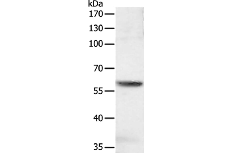 SOCS6 Antibody from Signalway Antibody (35925) - Antibodies.com