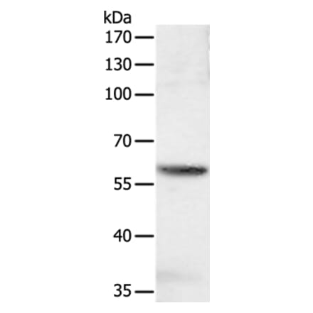 SOCS6 Antibody from Signalway Antibody (35925) - Antibodies.com