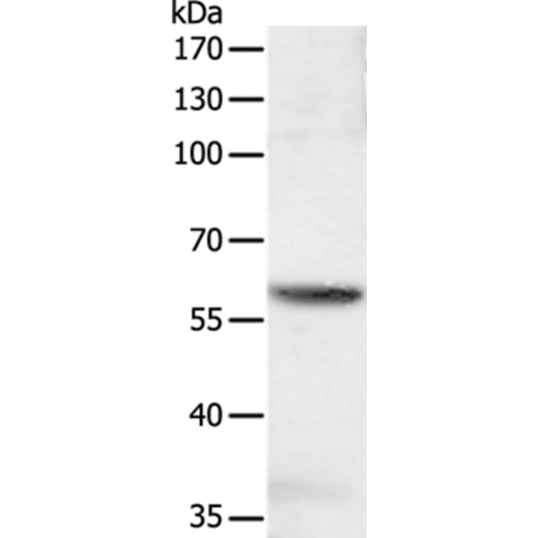 SOCS6 Antibody from Signalway Antibody (35925) - Antibodies.com