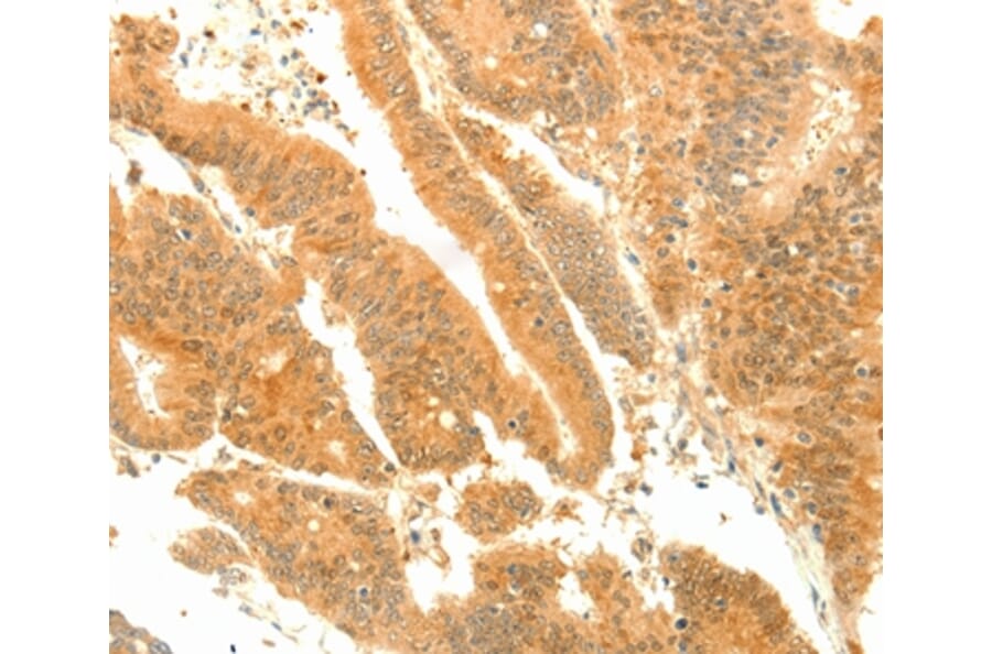Immunohistochemistry - SOCS6 Antibody from Signalway Antibody (35925) - Antibodies.com