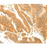 Immunohistochemistry - SOCS6 Antibody from Signalway Antibody (35925) - Antibodies.com