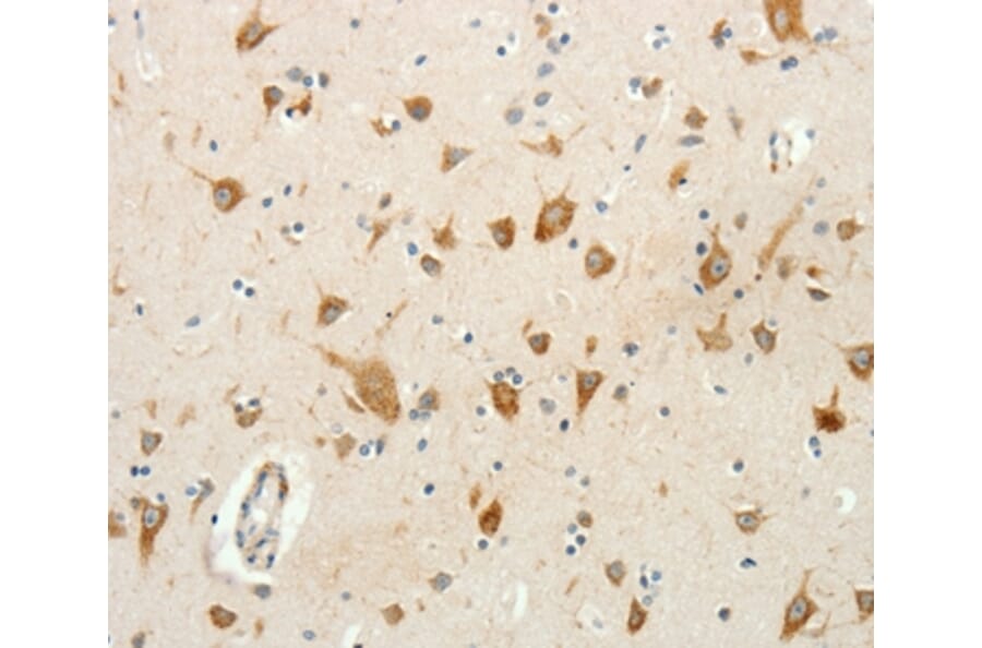 Immunohistochemistry - RPAP3 Antibody from Signalway Antibody (35926) - Antibodies.com