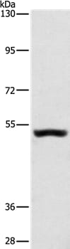 Gel: 6%SDS-PAGE Lysates (from left to right): Mouse kidney tissue Amount of lysate: 40ug per lane Primary antibody: 1/650 dilution Secondary antibody dilution: 1/8000 Exposure time: 1 minute