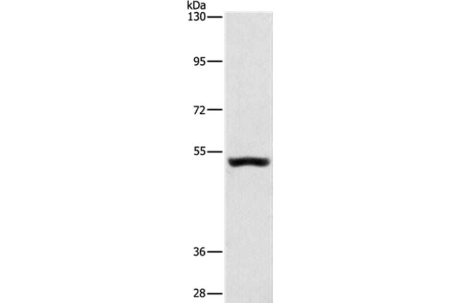 SYT17 Antibody from Signalway Antibody (35940) - Antibodies.com