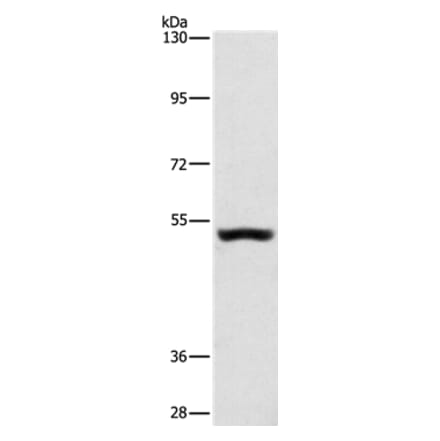 SYT17 Antibody from Signalway Antibody (35940) - Antibodies.com
