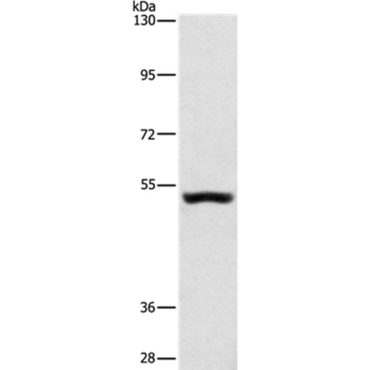 SYT17 Antibody from Signalway Antibody (35940) - Antibodies.com