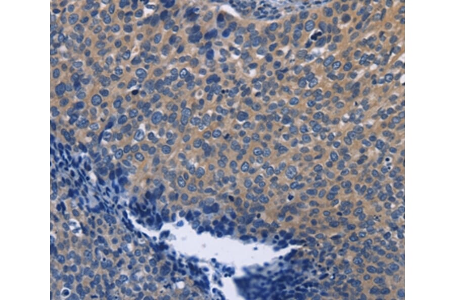 Immunohistochemistry - SYT17 Antibody from Signalway Antibody (35940) - Antibodies.com