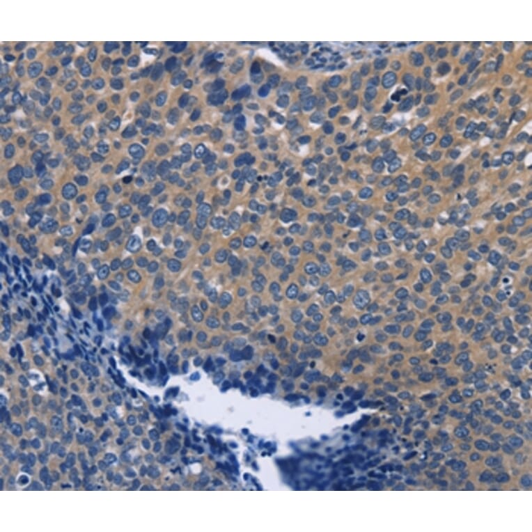 Immunohistochemistry - SYT17 Antibody from Signalway Antibody (35940) - Antibodies.com