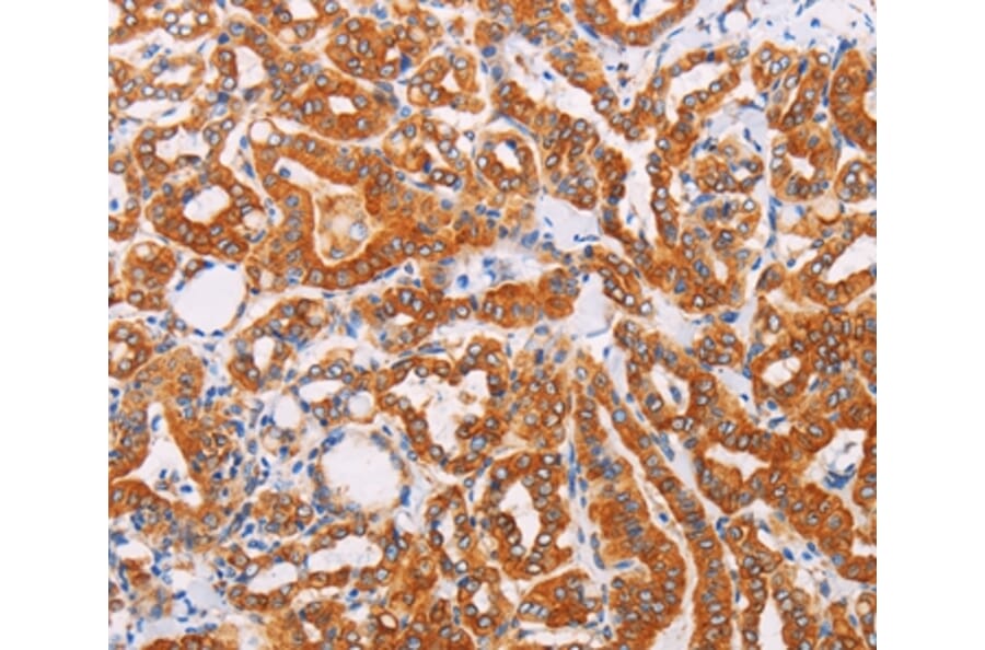 Immunohistochemistry - SYVN1 Antibody from Signalway Antibody (35945) - Antibodies.com