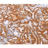 Immunohistochemistry - SYVN1 Antibody from Signalway Antibody (35945) - Antibodies.com