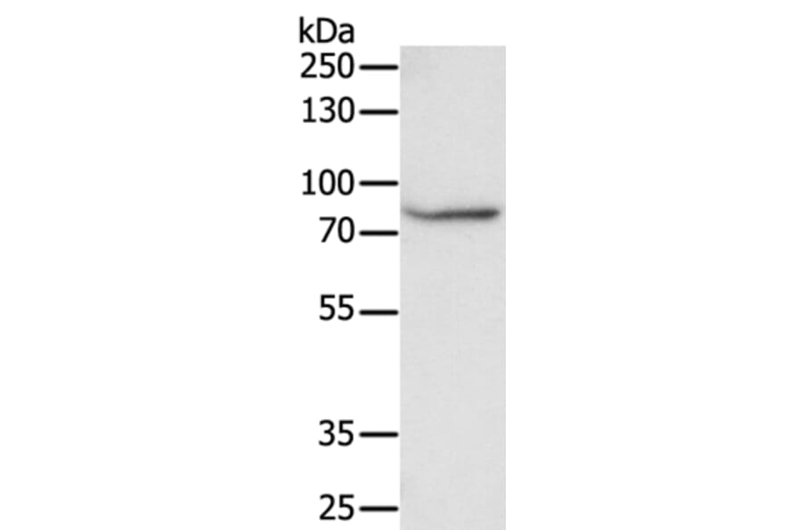 F13A1 Antibody from Signalway Antibody (35955) - Antibodies.com