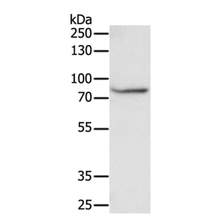 F13A1 Antibody from Signalway Antibody (35955) - Antibodies.com