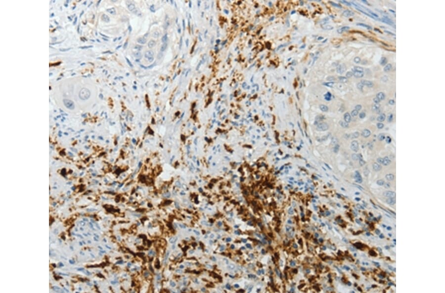 Immunohistochemistry - F13A1 Antibody from Signalway Antibody (35955) - Antibodies.com