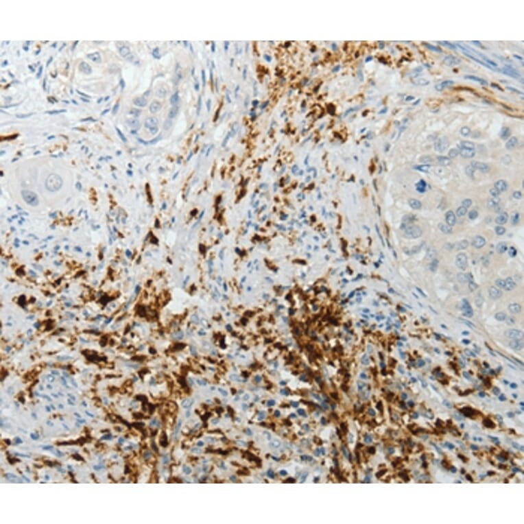 Immunohistochemistry - F13A1 Antibody from Signalway Antibody (35955) - Antibodies.com